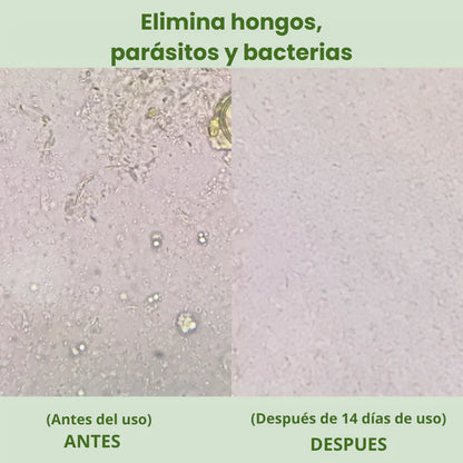 Aceite de Oregano Natural™ –  Bienestar Natural y Cuidado Diario (Oferta 2X1)